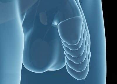 penile-ligament-release Ligament Release Penile Lengthening Tampa Bay
