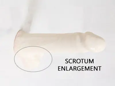 https://bestmanmedical.com/wp-content/uploads/scrotal-enhancement-tampa-fl.webp